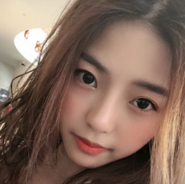 术前我是属于丹凤眼,眼角有点下坠,做了眼综合,做完之后眼睛改善了