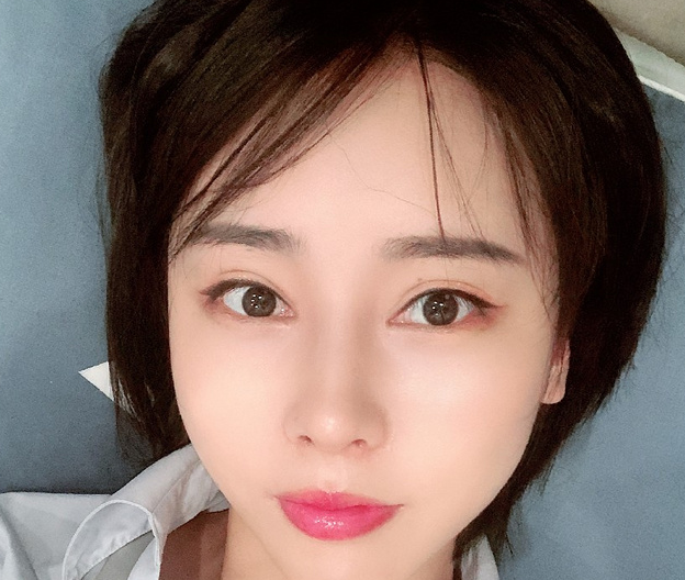 术前我是属于丹凤眼,眼角有点下坠,做了眼综合,做完之后眼睛改善了