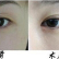 上海丽质医疗美容门诊部做全切双眼皮手术后效果自然吗？要多少钱呢？