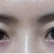 杭州时光做双眼皮修复多少钱？失败的双眼皮手术能修复吗？